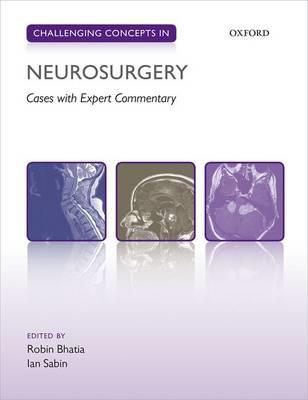 Challenging Concepts in Neurosurgery: Cases with Expert Commentary - Click Image to Close