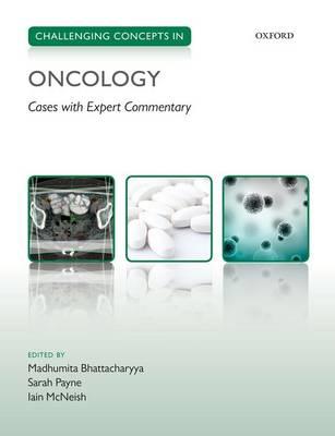 Challenging Concepts in Oncology - Click Image to Close