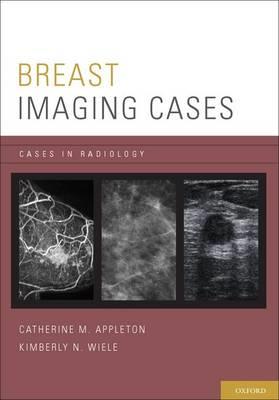 Breast Imaging Cases - Click Image to Close