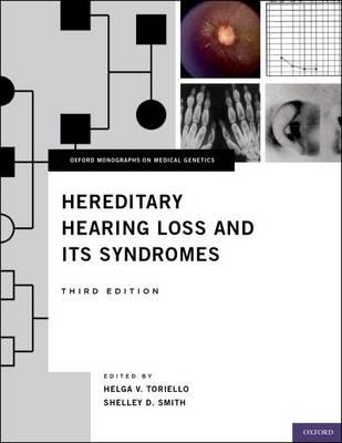 Hereditary Hearing Loss and Its Syndromes - Click Image to Close