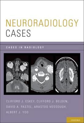 Neuroradiology Cases - Click Image to Close