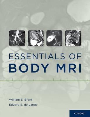 Essentials of Body MRI - Click Image to Close