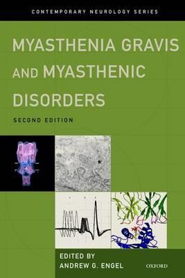 Myasthenia Gravis and Myasthenic Disorders - Click Image to Close