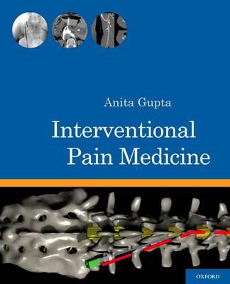 Interventional Pain Medicine - Click Image to Close