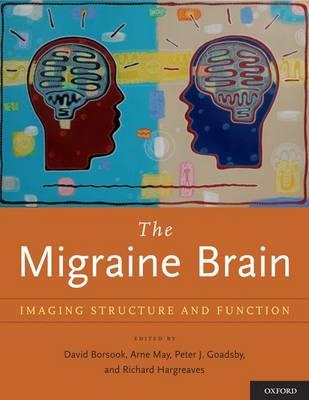 Migraine Brain: Imaging Structure and Function - Click Image to Close
