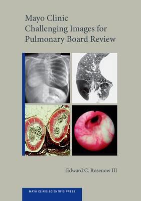 Mayo Clinic Challenging Images for Pulmonary Board Review - Click Image to Close