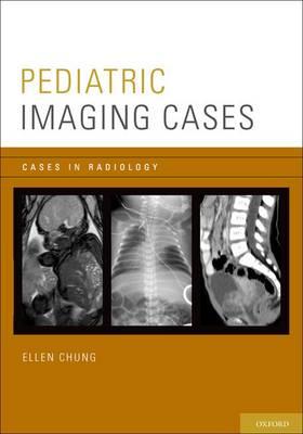 Pediatric Imaging Cases - Click Image to Close