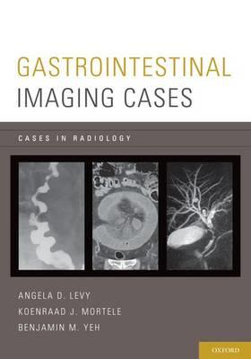 Gastrointestinal Imaging Cases - Click Image to Close