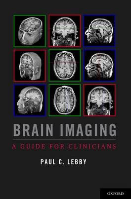 Brain Imaging - Click Image to Close