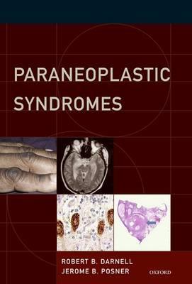 Paraneoplastic Syndromes - Click Image to Close