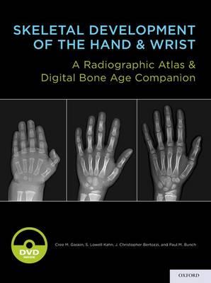 Skeletal Development of the Hand and Wrist: A Radiographic Atlas and Digital Bone Age Companion - Click Image to Close