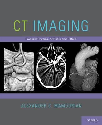 CT Imaging - Click Image to Close