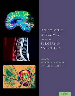 Neurologic Outcomes of Surgery and Anesthesia - Click Image to Close