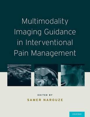 Multimodality Imaging Guidance in Interventional Pain Management - Click Image to Close