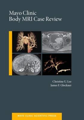 Mayo Clinic Body MRI Case Review - Click Image to Close
