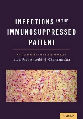 Infections in the Immunosuppressed Patient: An Illustrated Case-Based Approach - Click Image to Close