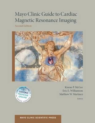 Mayo Clinic Guide to Cardiac Magnetic Resonance Imaging - Click Image to Close