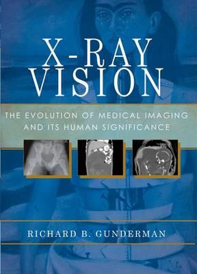 X Ray Vision - Click Image to Close