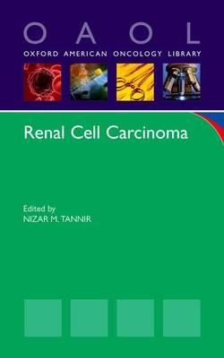 Renal Cell Carcinoma - Click Image to Close