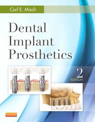 Dental Implant Prosthetics 2e - Click Image to Close