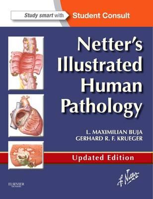 Netter's Illustrated Human Pathology - Click Image to Close
