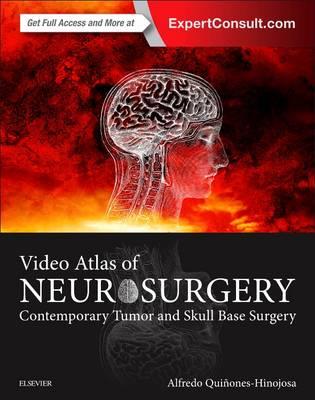 Video Atlas of Neurosurgery: Contemporary Tumor and Skull Base Surgery - Click Image to Close