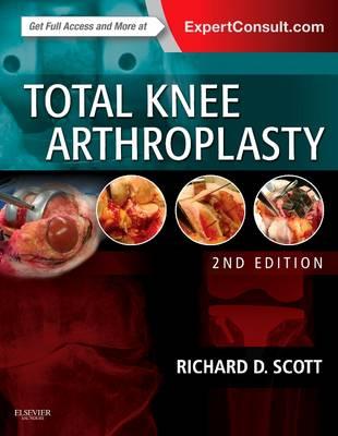 Total Knee Arthroplasty - Click Image to Close