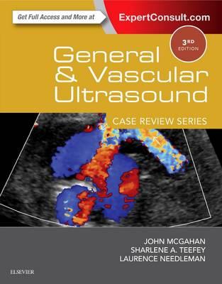 General and Vascular Ultrasound: Case Review Series - Click Image to Close