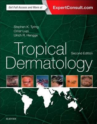 Tropical Dermatology 2nd edition - Click Image to Close