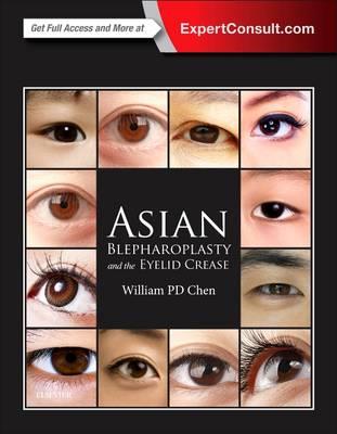 Asian Blepharoplasty and the Eyelid Crease - Click Image to Close