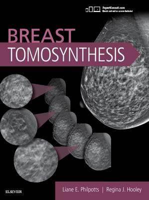 Breast Tomosynthesis - Click Image to Close