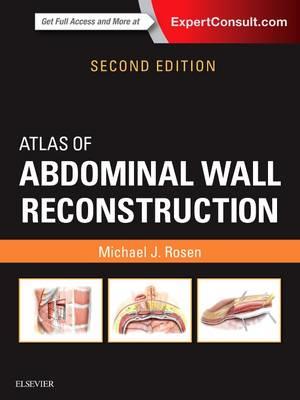 Atlas of Abdominal Wall Reconstruction - Click Image to Close