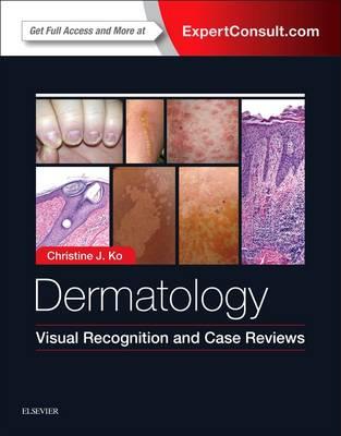 Dermatology: Visual Recognition and Case Reviews - Click Image to Close