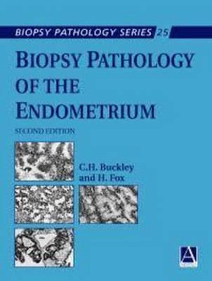 Biopsy Pathology of the Endometrium, 2Ed - Click Image to Close