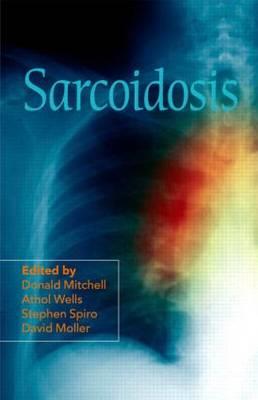 Sarcoidosis - Click Image to Close