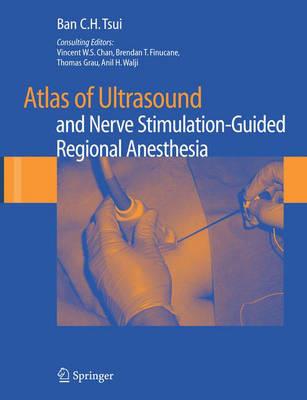 Atlas of Ultrasound and Nerve Stimulation Guided Regional Anesthesia - Click Image to Close
