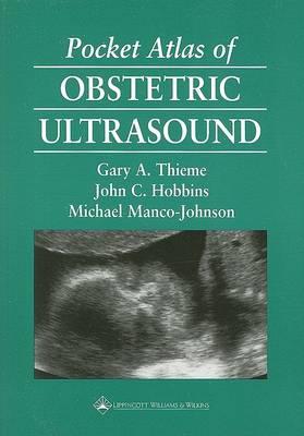 Pocket Atlas of Obstetric Ultrasound - Click Image to Close
