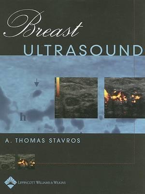 Breast Ultrasound - Click Image to Close