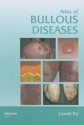 Atlas of Bullous Diseases - Click Image to Close