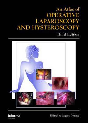 Atlas of Operative Laparoscopy and Hysteroscopy - Click Image to Close