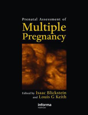 Prenatal Assessment of Multiple Pregnancy - Click Image to Close