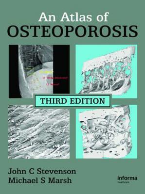 An Atlas of Osteoporosis - Click Image to Close