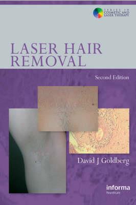 Laser Hair Removal - Click Image to Close