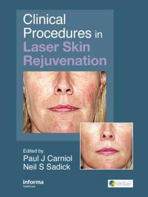 Clinical Procedures in Laser Skin Rejuvenation - Click Image to Close