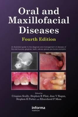 Oral and Maxillofacial Diseases, Fourth Edition - Click Image to Close