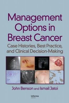 Management Options in Breast Cancer - Click Image to Close