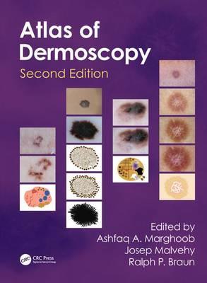 An Atlas of Dermoscopy - Click Image to Close