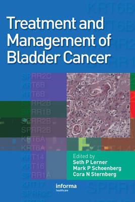 Treatment and Management of Bladder Cancer - Click Image to Close