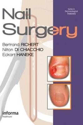 Nail Surgery - Click Image to Close