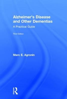 Alzheimer's Disease and Other Dementias: A Practical Guide - Click Image to Close